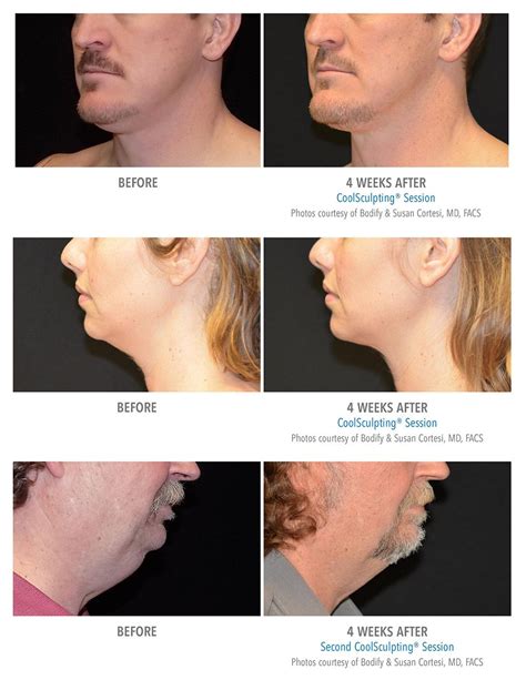 coolsculpting toledo|Toledo's Plastic Surgery and Medical Aesthetics Experts .